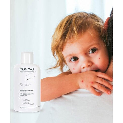 NOREVA SEDAX CREAM 125ML